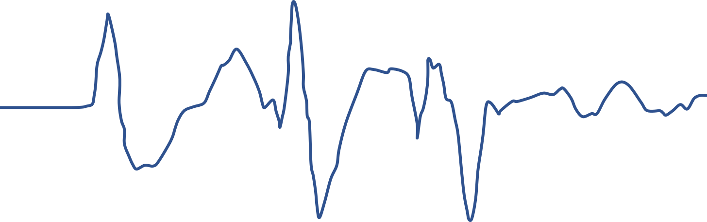 初始化阶段的呼吸波(较为紊乱)